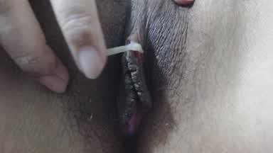 Profile of unpenetrated